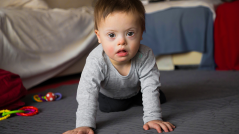 adorable baby boy with down syndrome